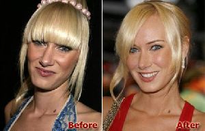 Kimberly Stewart : a-new-nose 460x295